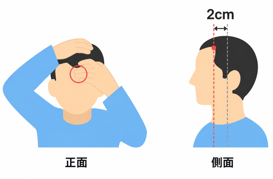 正面と側面から生え際の後退を確認する方法